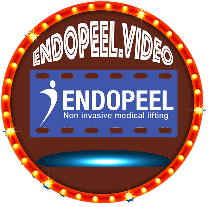 endopeel-video-logo